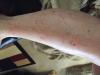 post-256320-0-93314300-1435533604_thumb.jpg