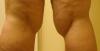 post-38-13813657079289_thumb.jpg