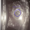 post-42877-13813667972531_thumb.png