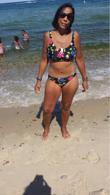 Buyer's Remorse- My Horrible Road To "recovery" Post Sleevectomy