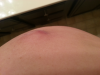 post-351947-13813142125716_thumb.png