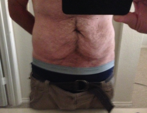 Post-Surgery Abdominal Surgery Recommendations (Austin, TX)