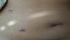 post-121268-0-77695200-1439498150_thumb.jpg