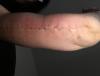 post-237953-0-69113300-1471985954_thumb.jpeg