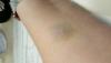 post-275798-14708407778699_thumb.jpg