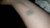 post-275798-14709257874821_thumb.jpg