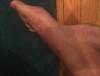 post-293995-0-47388500-1471913872_thumb.jpeg