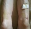 post-298441-14714804056682_thumb.jpg
