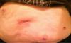 post-40160-1381366017788_thumb.jpg