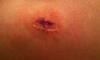 post-40160-13813660179387_thumb.jpg