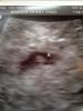 post-34674-13813813228831_thumb.jpg