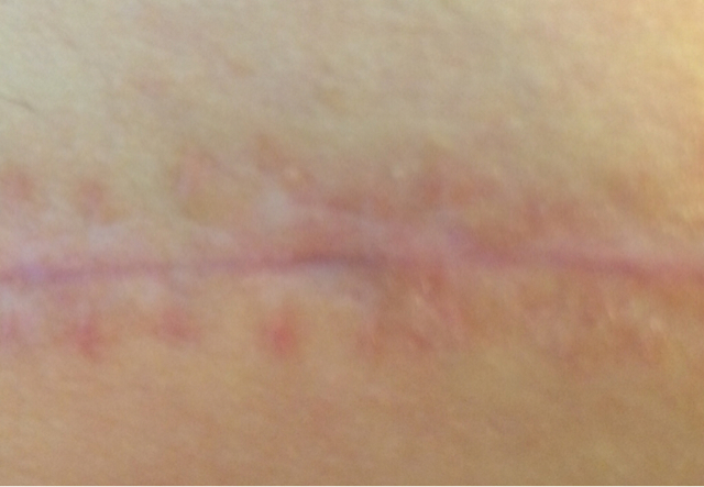 PLASTIC SURGERY IN BRAZIL