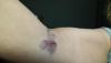 post-288435-0-08209600-1473118291_thumb.jpg