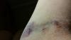 post-288435-0-12782000-1473118318_thumb.jpg