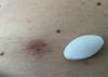 post-300870-14763277766309_thumb.jpg
