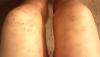 post-38-13813657824691_thumb.jpg