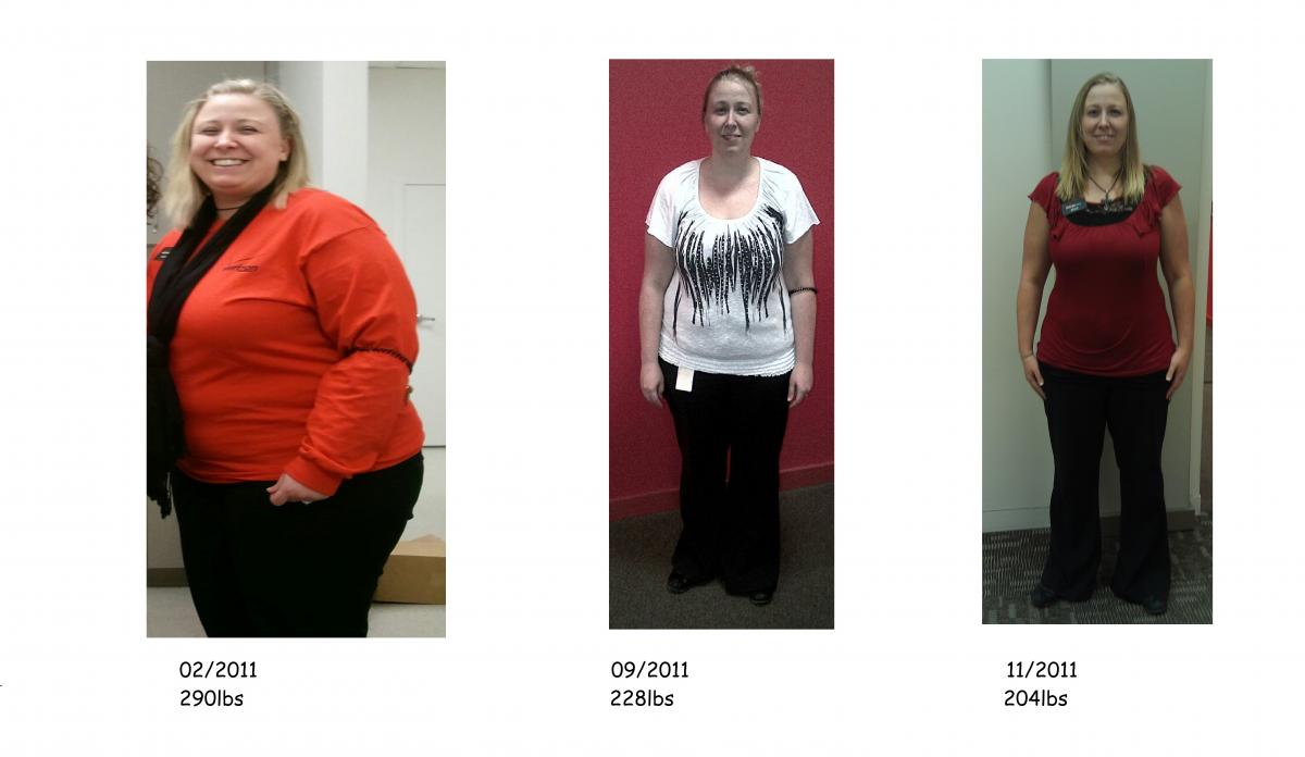 4 Months After Gastric Sleeve Surgery