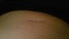 post-121268-14464575290724_thumb.jpg
