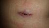 post-200380-0-08441400-1387458840_thumb.jpg