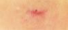 post-194772-14188234000223_thumb.jpg