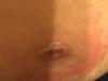 post-235696-14185335151674_thumb.jpg