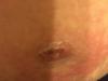 post-235696-14185336518368_thumb.jpg