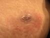 post-235696-14185349320727_thumb.jpg