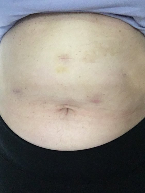 ImageUploadedByBariatricPal1486825508.588176.jpg