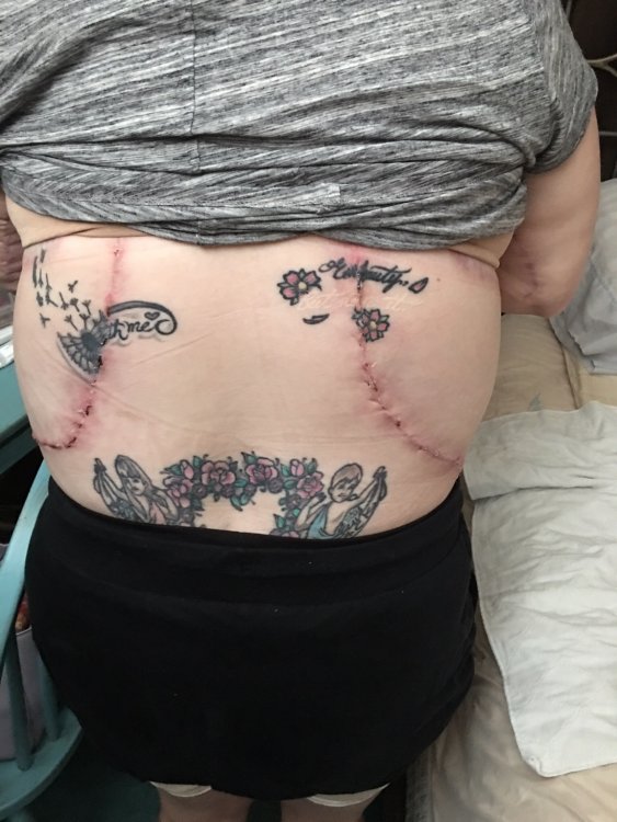 ImageUploadedByBariatricPal1486836424.927737.jpg