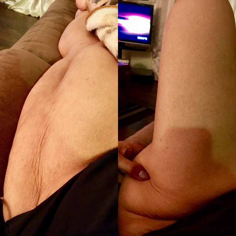 ImageUploadedByBariatricPal1487695673.747800.jpg