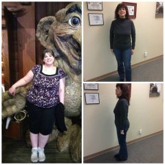 Surgiversary Changes