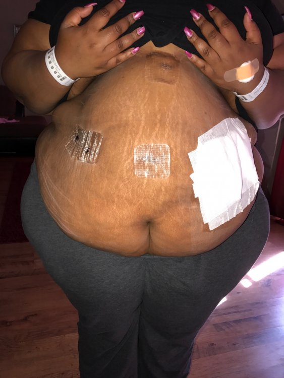 ImageUploadedByBariatricPal1488480528.591813.jpg