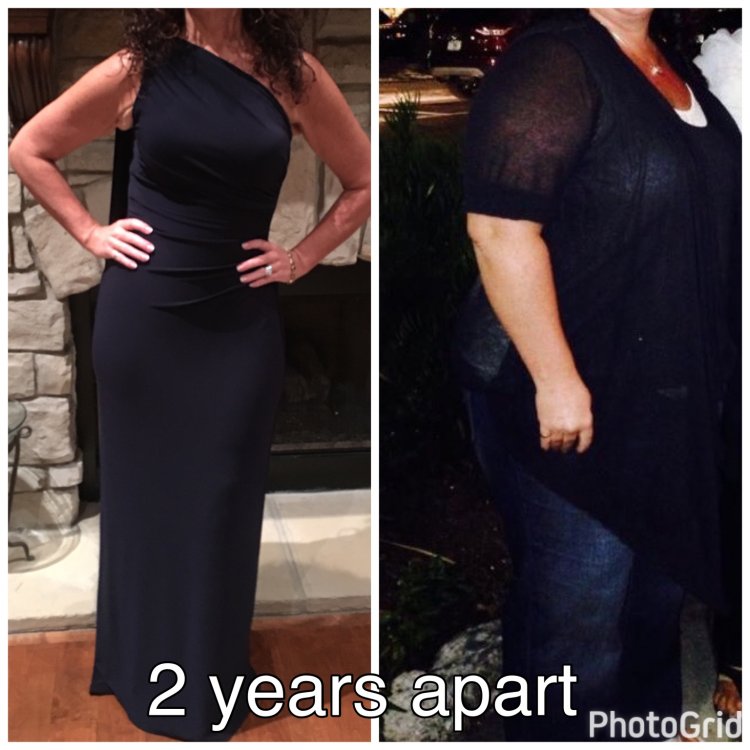 ImageUploadedByBariatricPal1488850530.224871.jpg