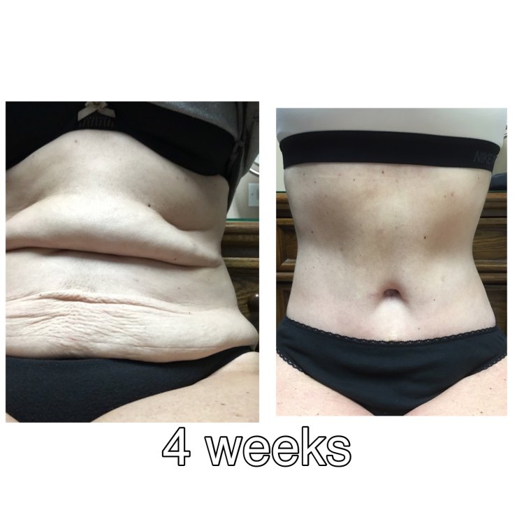 ImageUploadedByBariatricPal1488850547.617871.jpg