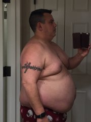 Before surgery