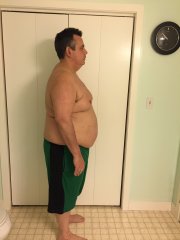 14 days after surgery