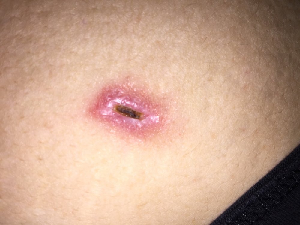ImageUploadedByBariatricPal1494382410.828767.jpg