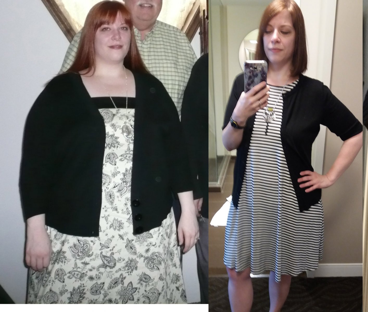 Before and After