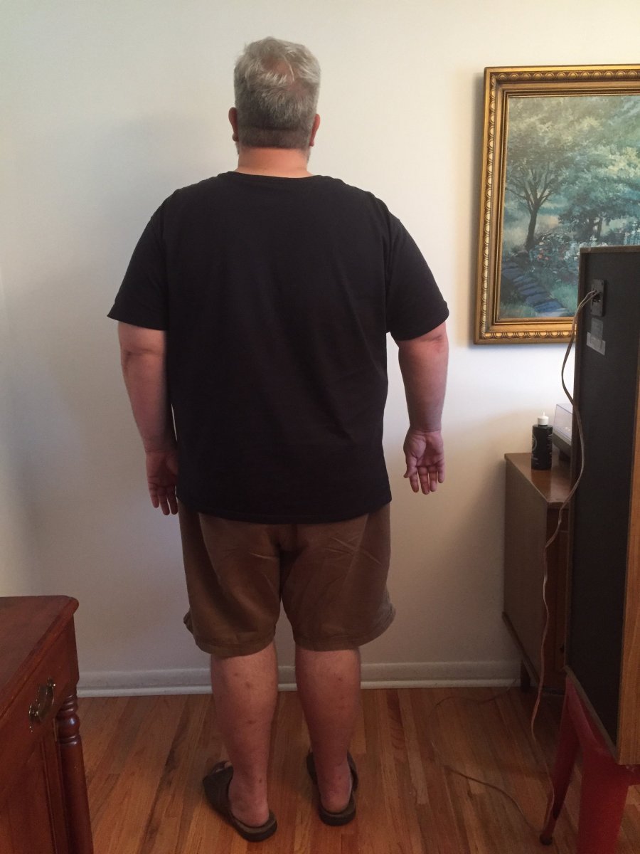 Before Photos
