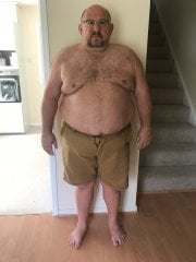 Before pre-Op diet begins