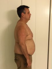 4 months post op