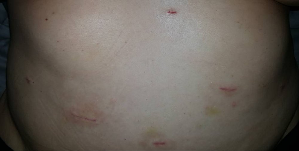 20170915_092319.thumb.jpg.c7e2ac725e75ba0ee4bac5000d1795e7.jpg