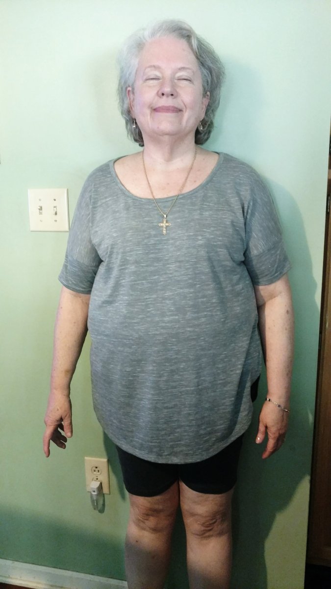 Weight Loss Journey