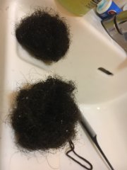 Hair Loss At it's Max