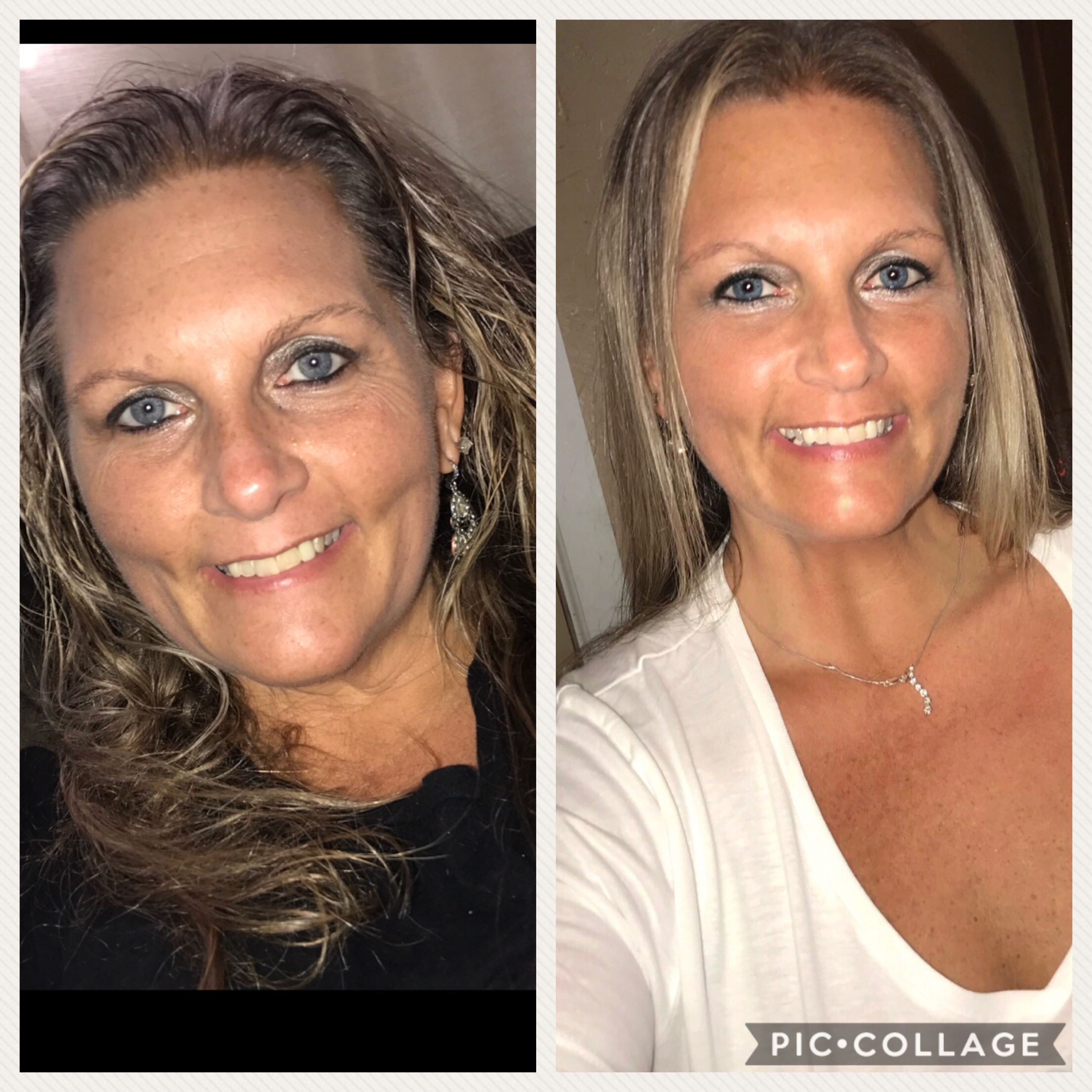 My one month “surgiversary”