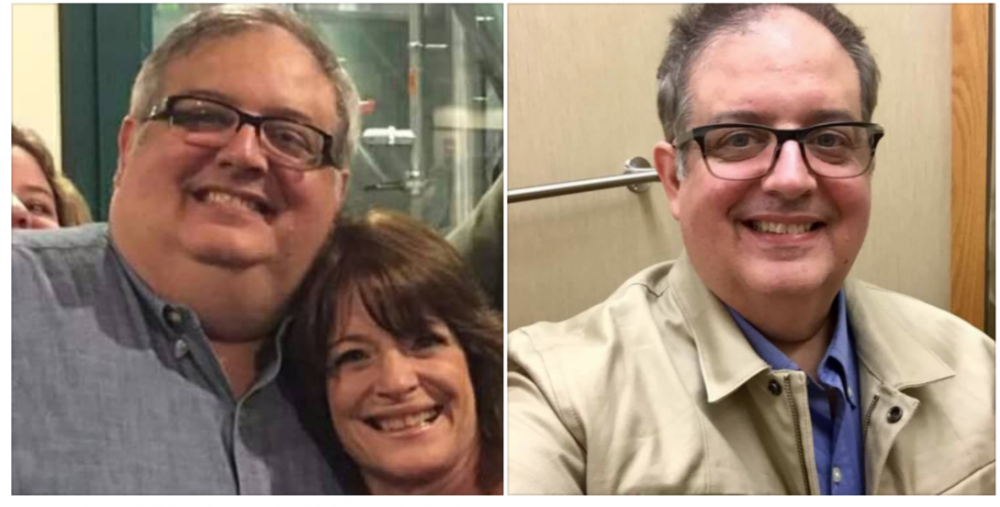 beforeafter.thumb.png.c392f93d04b542996478795659969be8.png
