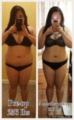 pre-op vs 50 pounds down