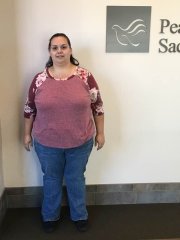 6 months post op