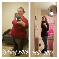 Before & After Surgery