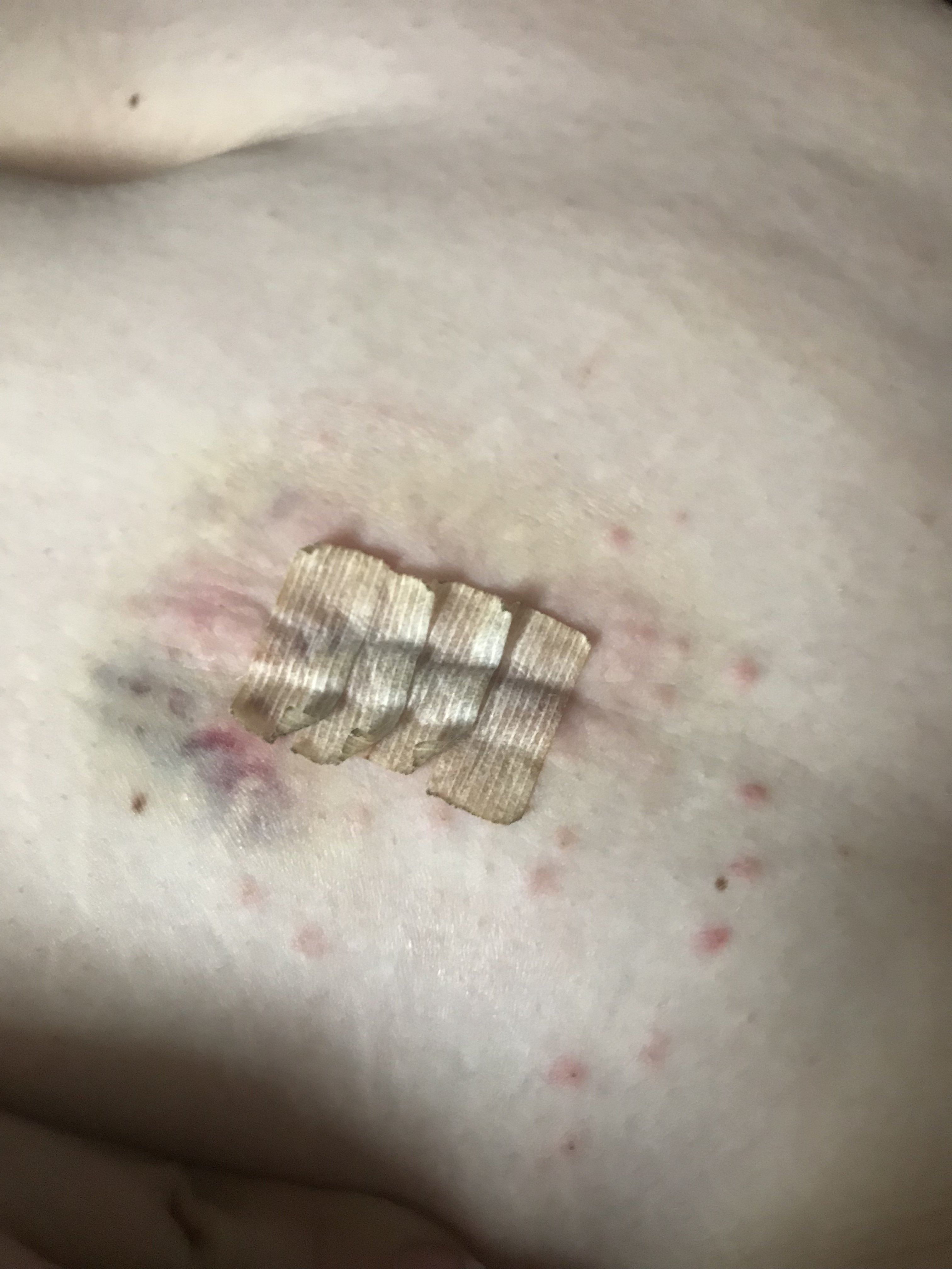 Uncontrollable Itch (WARNING Picture included)
